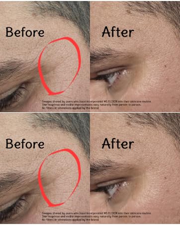 Vitamin C Illuminating Face Serum | Niacinamide 5% + Hyaluronic Acid & Ceramides | Hydrating, Brightening & Helps Prevent Early Signs of Aging | Gentle Skincare for Sensitive Skin | 1 fl oz