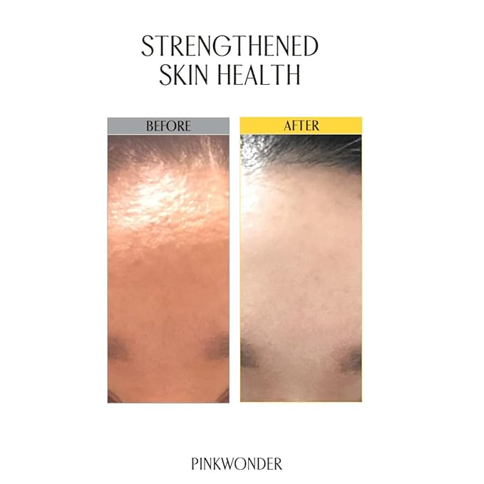 PINKWONDER Jojoba Barrier Repair Cream for Dry & Sensitive Skin 1.69oz