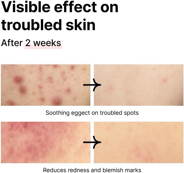 PINKWONDER Tamanu Salt Vitamin B12 Essence Toner for Sensitive Skin 5.07oz