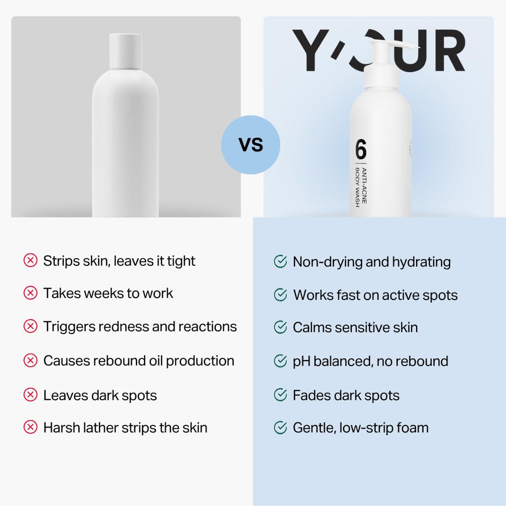 Y'OUR Anti-Acne Body Wash - Clears Bacne & Breakouts, Naturally Antibacterial Aloe Vera Formula, Smooths Texture & Brightens Tone, Gentle Non-Drying, Paraben & Sulfate Free, for Women & Men