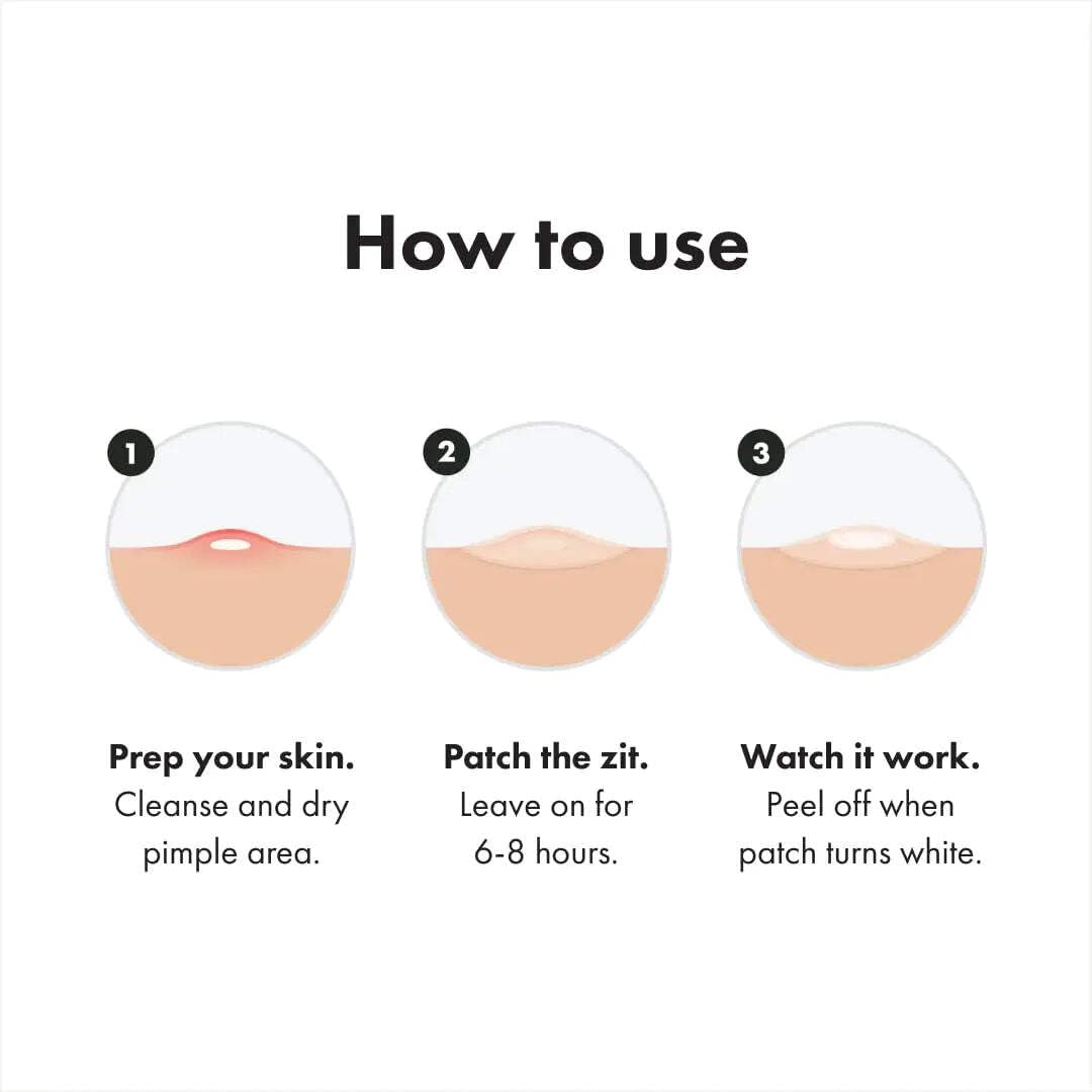 Mighty Patch Hero Cosmetics Variety Pack of Acne Pimple Patches, 26 Ct