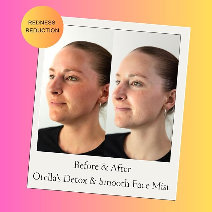 Otella Detox & Soothe Face Mist with Hypochlorous Acid.02% | 2.7 oz | Helps Reduce Redness, Irritation, Breakouts | Rosacea, Eczema, Sensitive-skin Safe | pH Balanced, Fragrance=Free, Fine Mist Toner