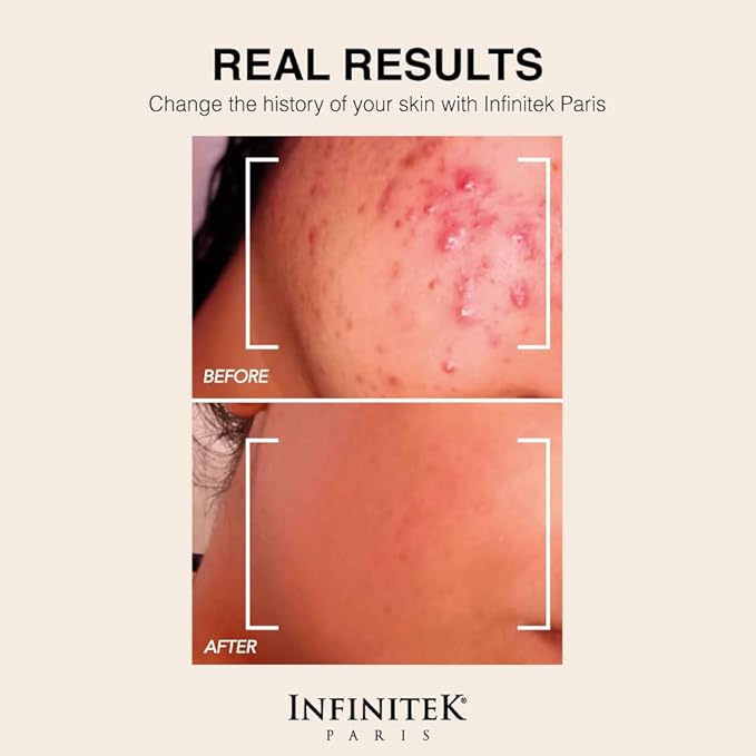 Infinitek Paris Retinol Face Moisturizer | 1% Retinol Cream with Hyaluronic Acid | Facial Cream for Wrinkles, Fine Lines, and Dark Spots | 1.7 oz / 50 g
