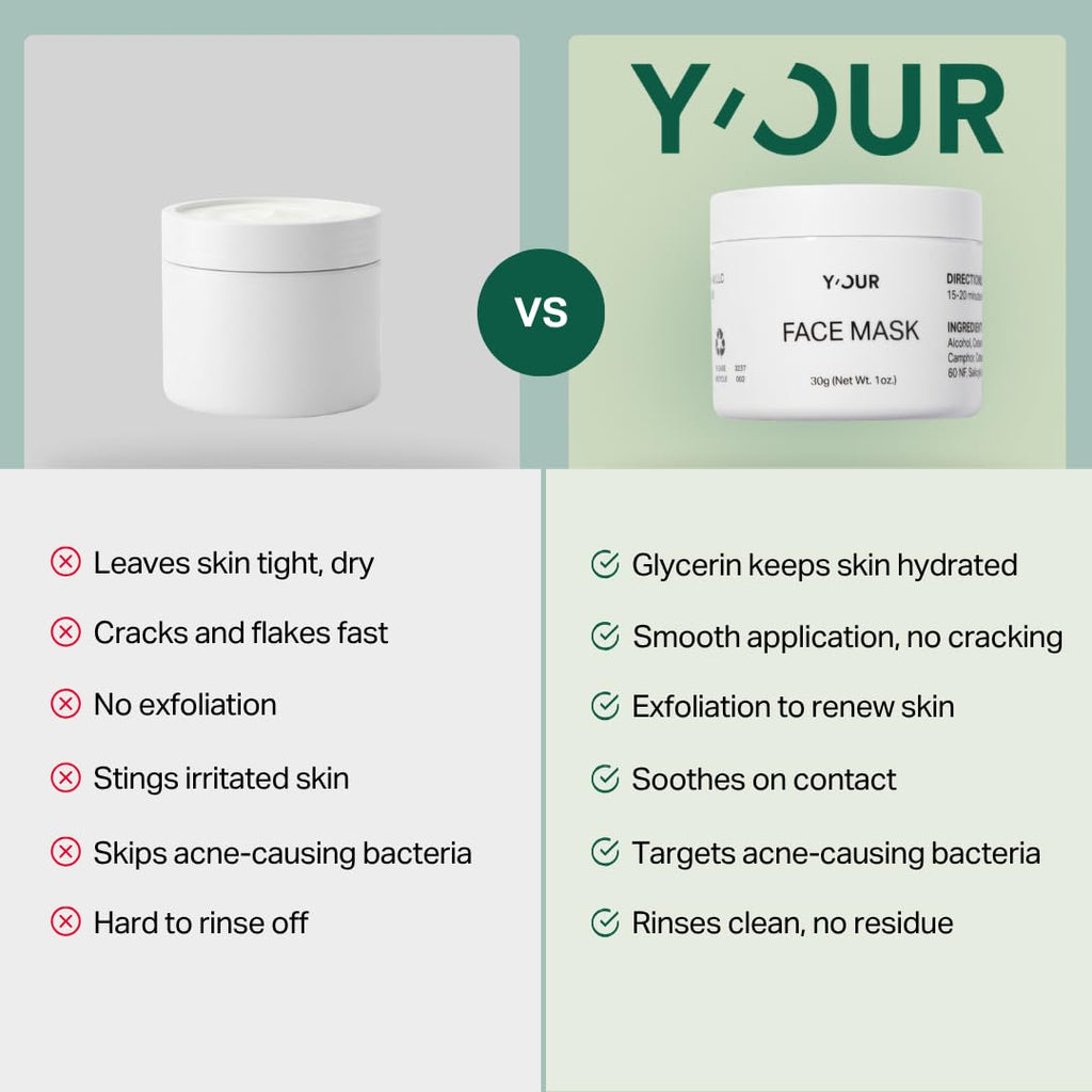Y’OUR Purifying Detox Face Mask: Blackhead, Whitehead & Pore Remover; Anti-Acne & Pimple Care; Cleansing & Exfoliating; With Salicylic Acid & Bentonite Clay Mud Mask