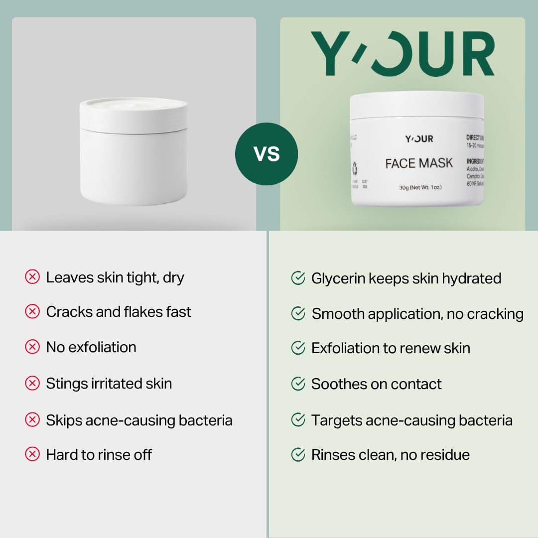 Y’OUR Purifying Detox Face Mask: Blackhead, Whitehead & Pore Remover; Anti-Acne & Pimple Care; Cleansing & Exfoliating; With Salicylic Acid & Bentonite Clay Mud Mask