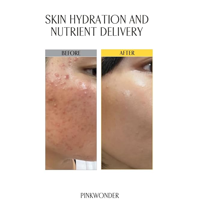 PINKWONDER Jojoba Facial Toner, Hydrating for Dry & Sensitive Skin 6.76oz