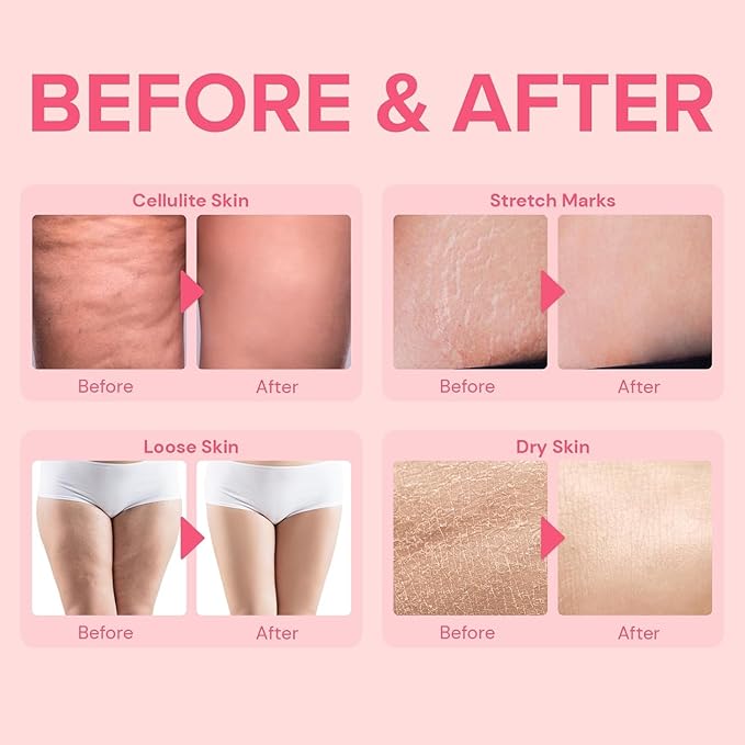 Cellulite Remover for Legs & Inner Thigh- Skin Tightening Lotion for Womens' Booty, Stomach & Belly