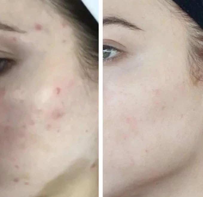 HigherDOSE Glow Serum - Facial Serum Formulated to Plump, Hydrate, and Stimulate Radiant Skin - Help Reduce Fine Lines and Wrinkles - 1 oz