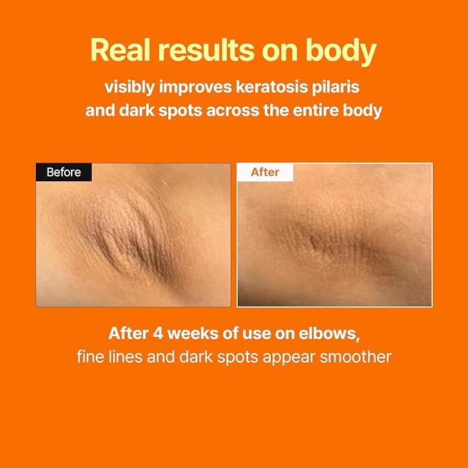 MEDITHERAPY Retinal Skin Booster Serum 5.07 fl oz | Retinaldehyde, Niacinamide, Cica | Korean Hydrating Face & Body Serum for Dull, Uneven Skin, All Skin Types, K-Beauty