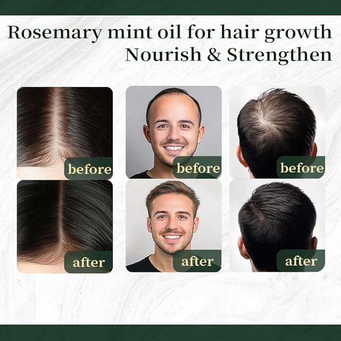 NP NATURES PHILOSOPHY Rosemary Mint Hair Growth Oil, Stimulates Hair Regrowth, Anti-Hair Loss, Nourishing Scalp Treatment for Thicker Fuller Hair, Hair Growth Products for All Hair 30ml Essential Oil