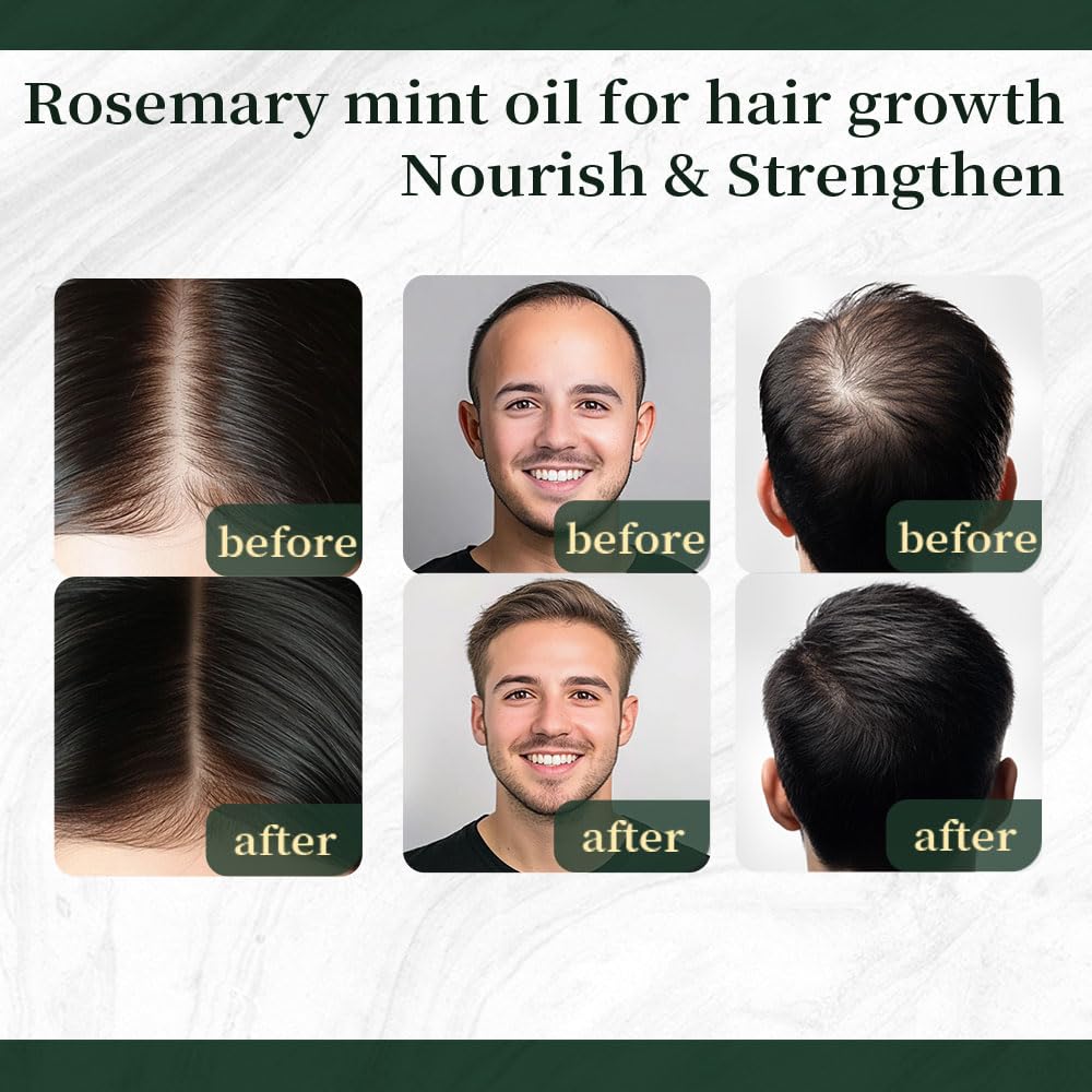 NP NATURES PHILOSOPHY Hair Growth Oil + Eyelash Growth Serum Set, Rosemary Mint Oil for Hair Growth, Prostaglandin-Free Lash & Brow Enhancing Serum, Vegan, Aussie Formula for Men Women