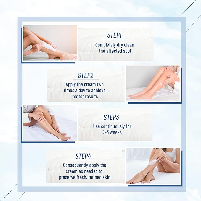 OUKEYA 40 Percent Urea Cream Hand Foot Cream for Dry Cracked Skin