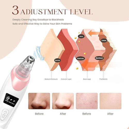 2026 Blackhead Remover Pore Vacuum,Facial Pore Cleaner-5 Suction Power,5 Probes,USB Rechargeable Blackhead Vacuum Kit Electric Pore Vacuum Tool for Adult