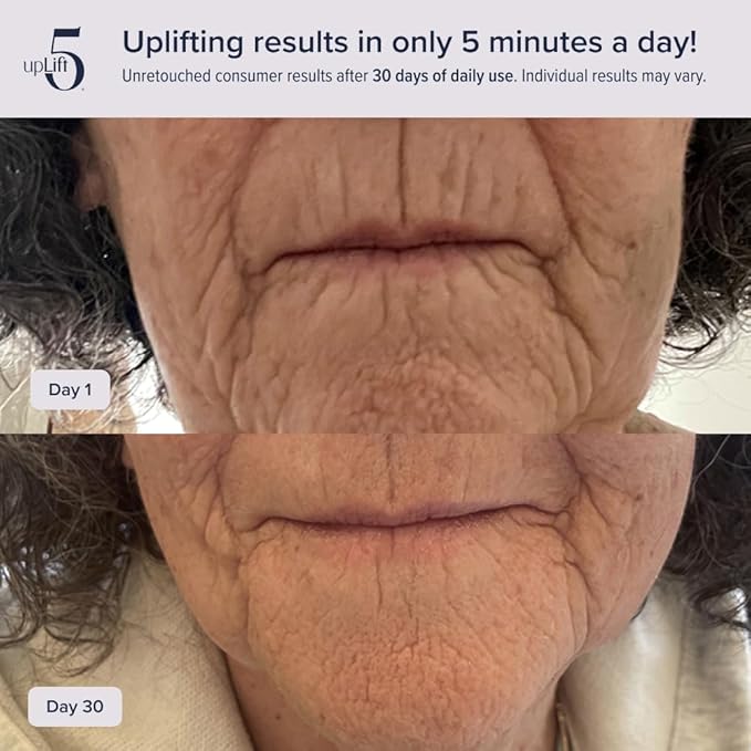 upLift 5 Anti-Aging Device | Prevent Long-Term Facial Decline