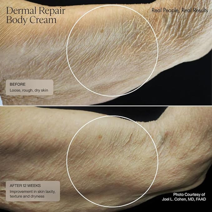 Senté Dermal Repair Body Cream | Firming, Promotes Collagen, 8 Fl Oz