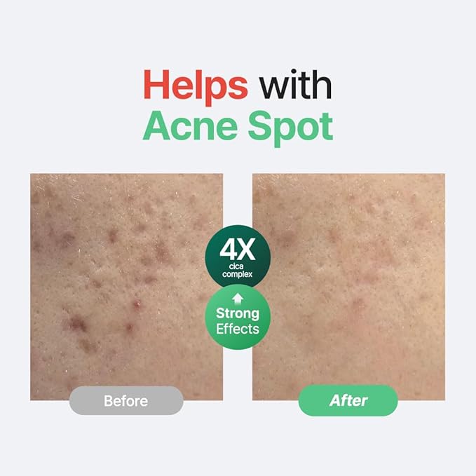 PURITO Centella Unscented Serum | Barrier Recovery For Sensitive Skin