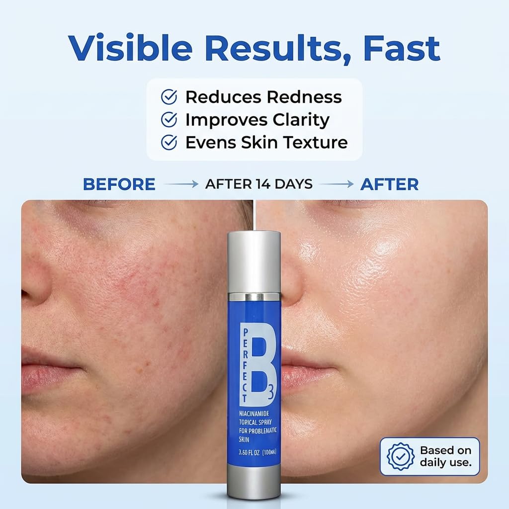 Perfect B3 Niacinamide Spray for Face, Vitamin B3 Face Mist 3.6oz