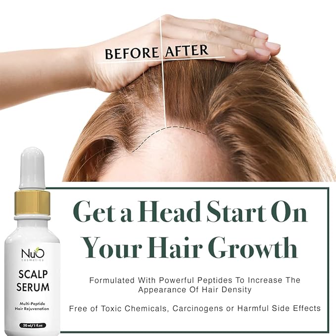 Dry Scalp Serum for Itchy, Flaky Scalp, Hydrating Scalp Treatment, 30ml