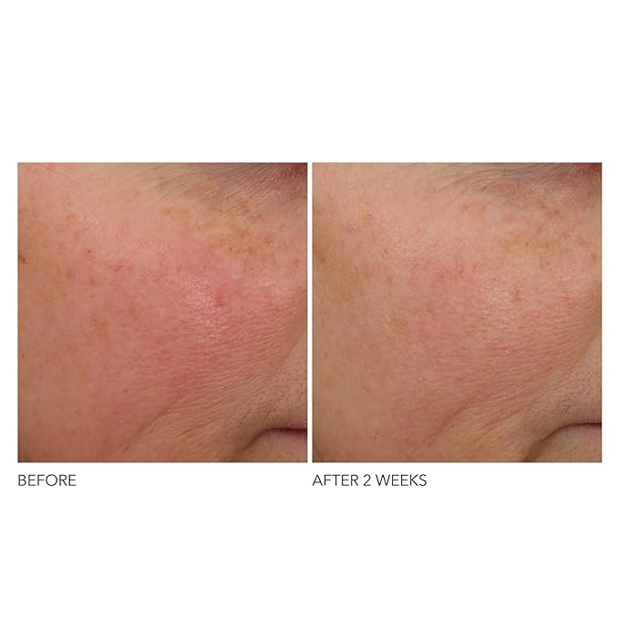 Dr Dennis Gross Advanced Retinol and Ferulic Overnight Wrinkle Treatment, White, 1 oz/ 30 mL