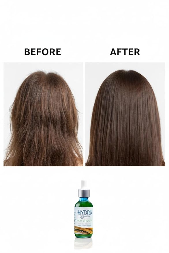 Hydr8 Organics Hair Growth Oil 4 oz – Castor Oil, Biotin & Rosemary Scalp Treatment for Thicker Hair | Anti Hair Loss, Regrowth & Thickening Serum | For Curly, Wavy, Thinning Hair & Beard