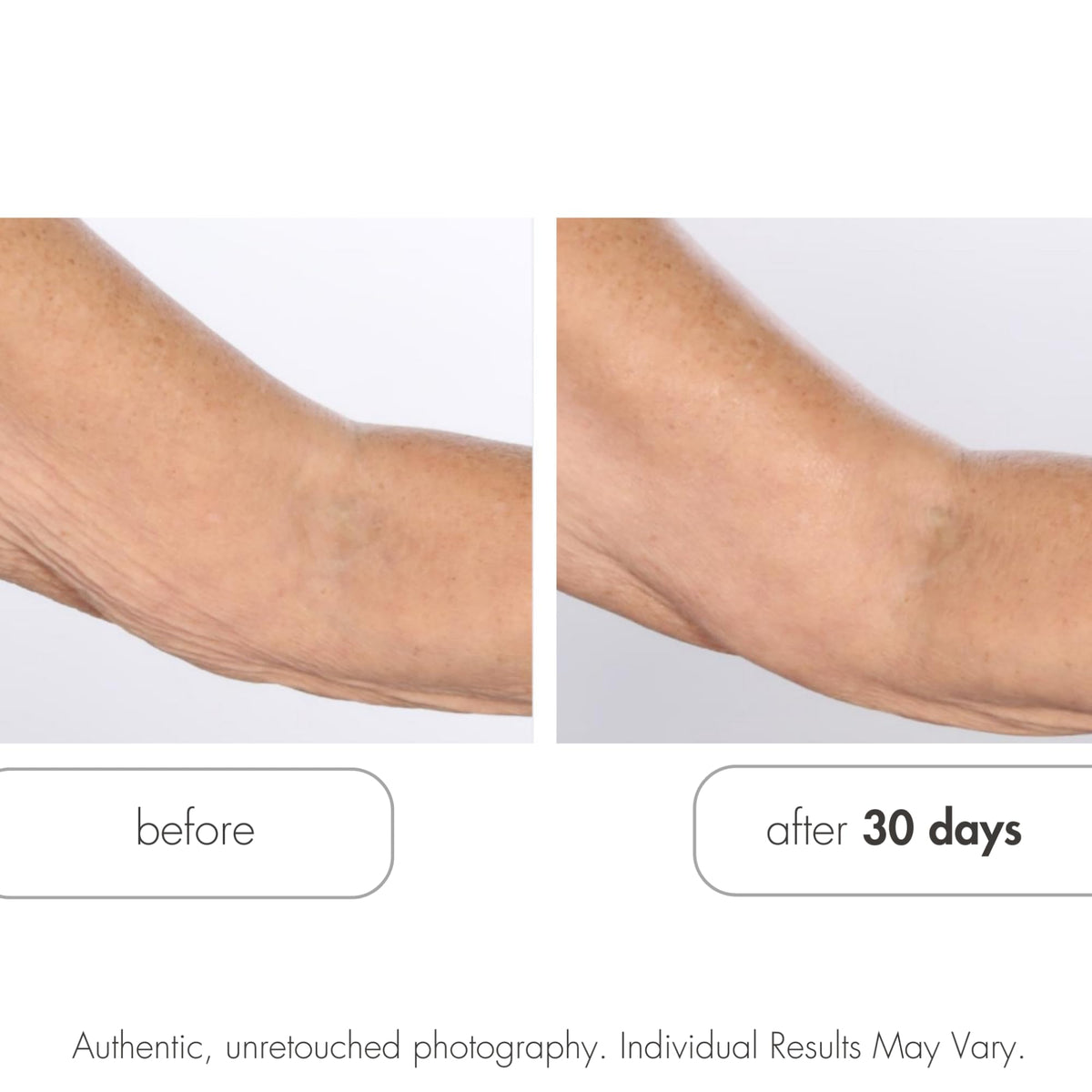 Serious Skincare Glycolic Retexturizing Toning Body Cream with BODY FIT™