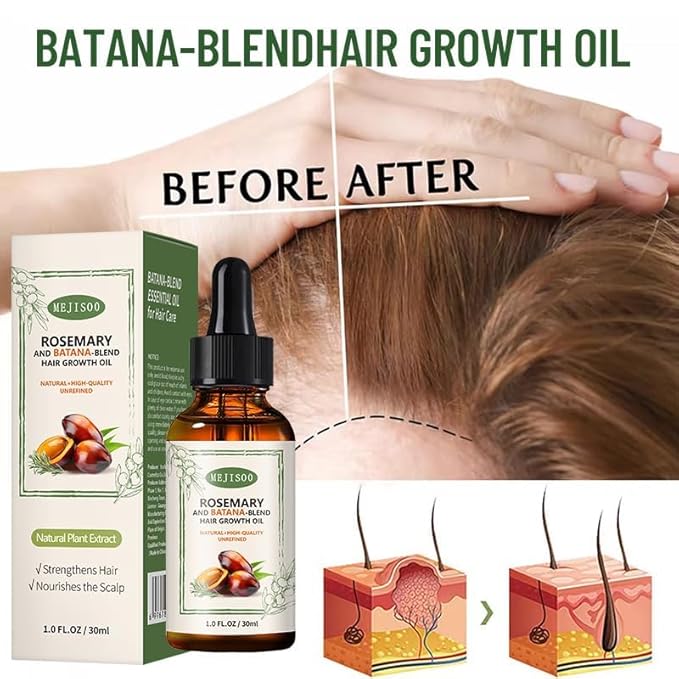 UPsyussa 2 Pack Organic Batana Rosemary Oil for Hair Growth & Anti-Hair Loss, 2PCS 1 fl oz Natural DHT Blocker Scalp Treatment for Thinning Hair, Nourishing Dry Scalp & Strengthening Follicles