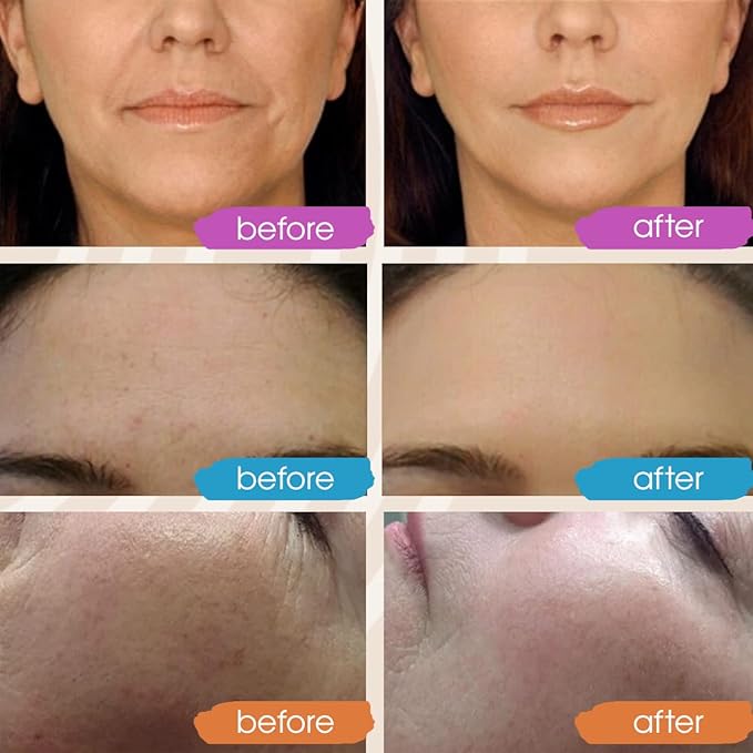 GLEOW Vitamin C Serum for Face with Hyaluronic Acid and Vitamin E, Brightening Face Serum Targets the Appearance of Fine Lines and Uneven Skin Tone, 2 oz