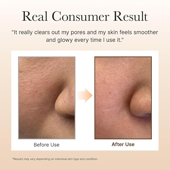 ARENCIA Calendula Rice Mochi Fresh Cleanser - Moisturizing & Deep-Cleansing (4.23oz)