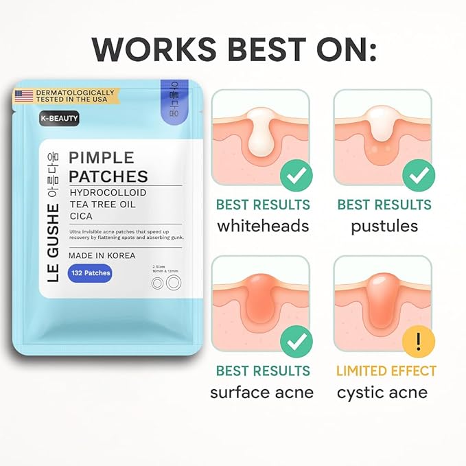 LE GUSHE Korean Pimple Patches for Face (132 Dots) - Hydrocolloid Acne Patches & Zit Patches with Tea Tree Oil - Invisible Blemish Patches - Dermatologist Tested Korean Skin Care