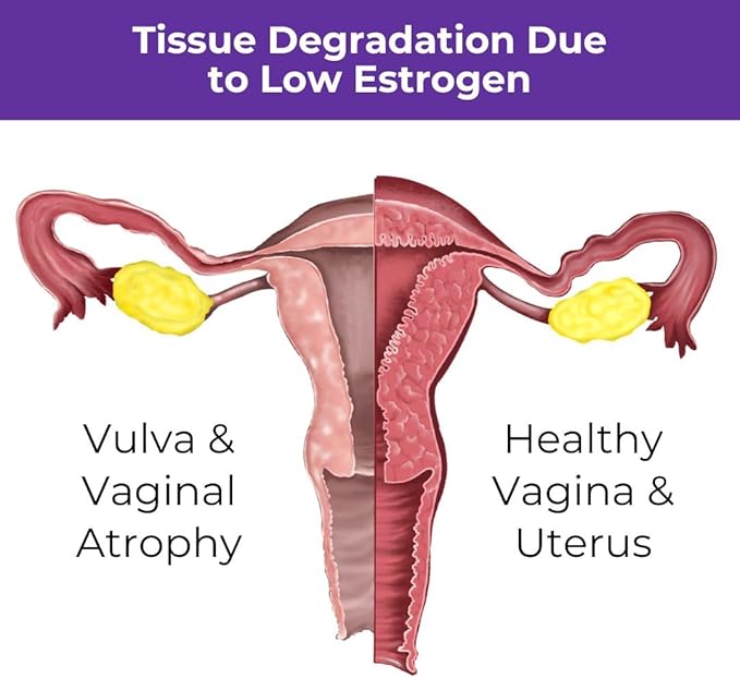 Menopause Rebalancing Bundle: Silky Peach Estriol Cream & Vibrant Third Progesterone Cream for Women. Bioidentical Estrogen & Progesterone for Intimate Comfort, Restful Sleep & Everyday Clarity