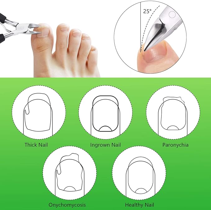 Heavy Duty Ingrown Toenail Clippers, Stainless Steel Toe Nail Trimmer