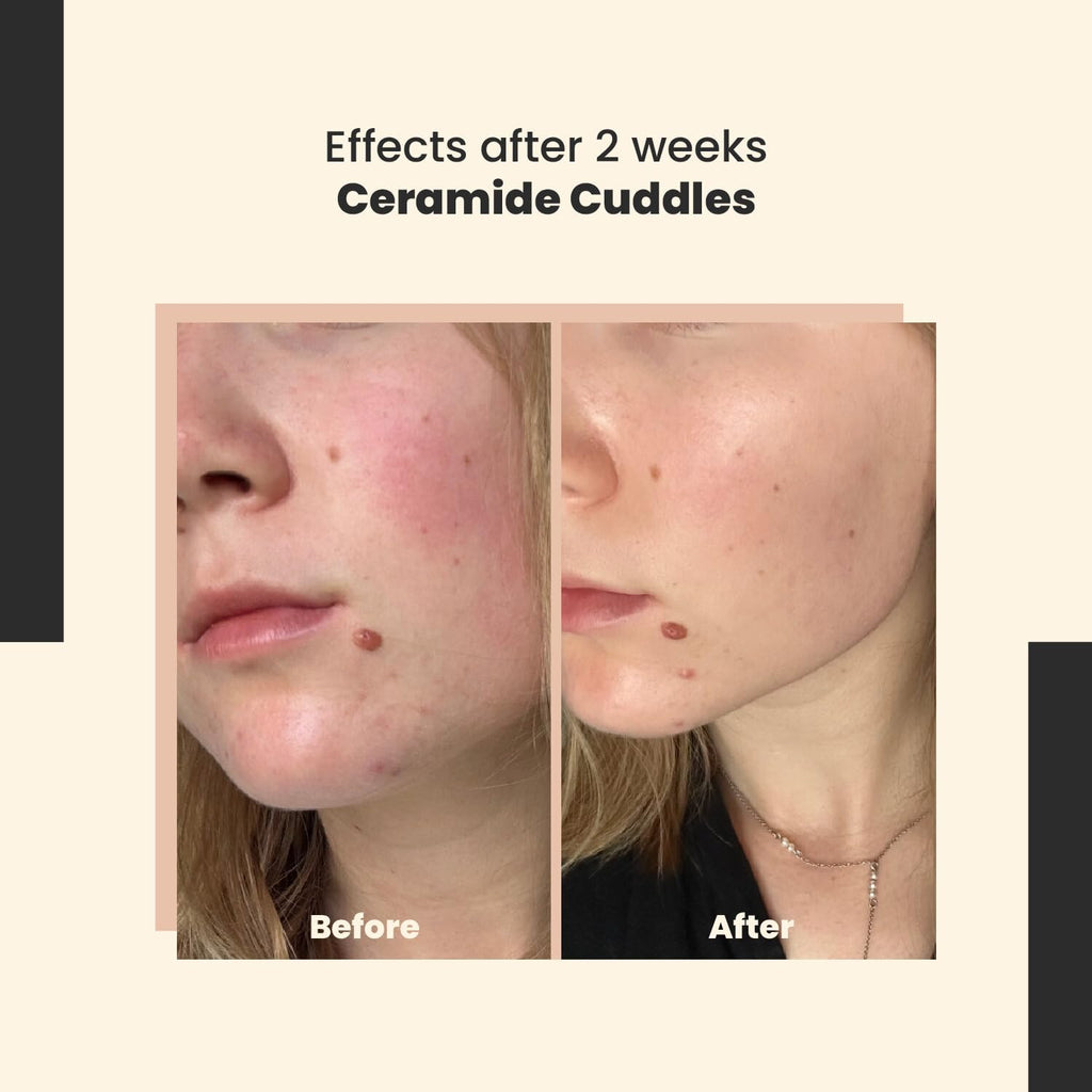 SkinTra Ceramide Cuddles - Regenerating Ceramide Serum for Barrier Repair and Hydration – Calming and Redness-Reducing – All Skin Types – 30 ml/Net 1.01 Fl. Oz