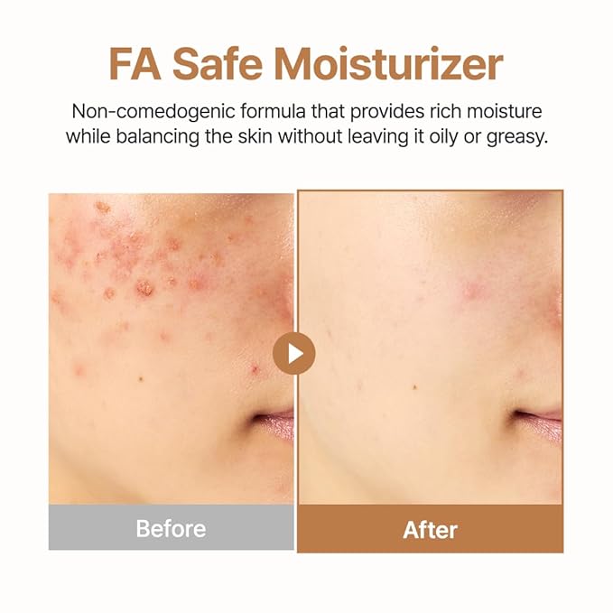 PURITO Oat Calming Gel Cream | Soothing Blemish Care for Sensitive Skin