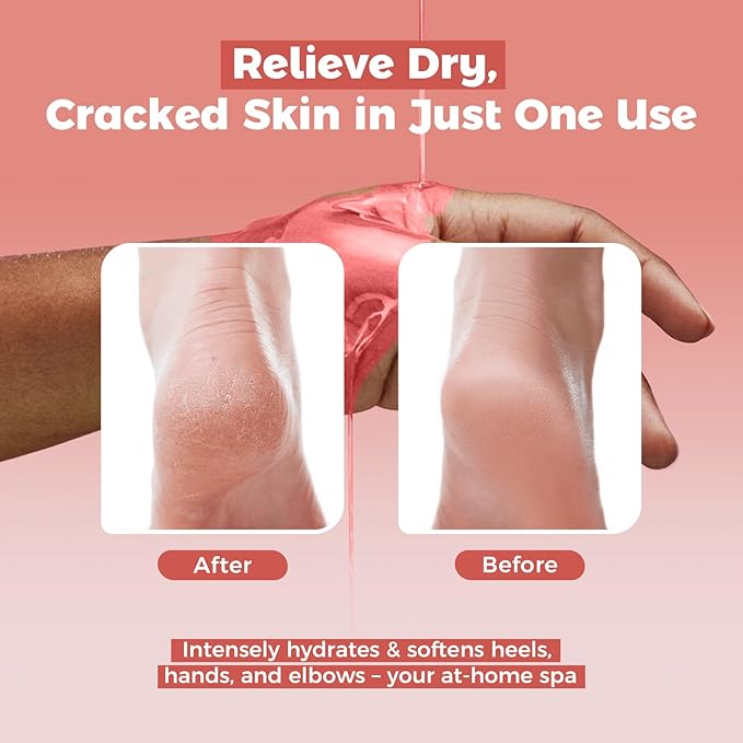 GIRLEARLE Paraffin Wax Refills 10 Packs for Paraffin Wax Bath Machine - for Dry Cracked Skin on Hands, Feet, Elbows - Moisturizing Hydration to Relieve Stiff Muscles & Joints (Rose)