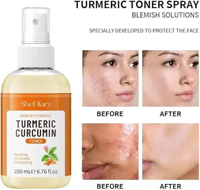 Turmeric Toner Spray Calming Hydrating Soothing Oil Control Moisturizing Face Mist (3)