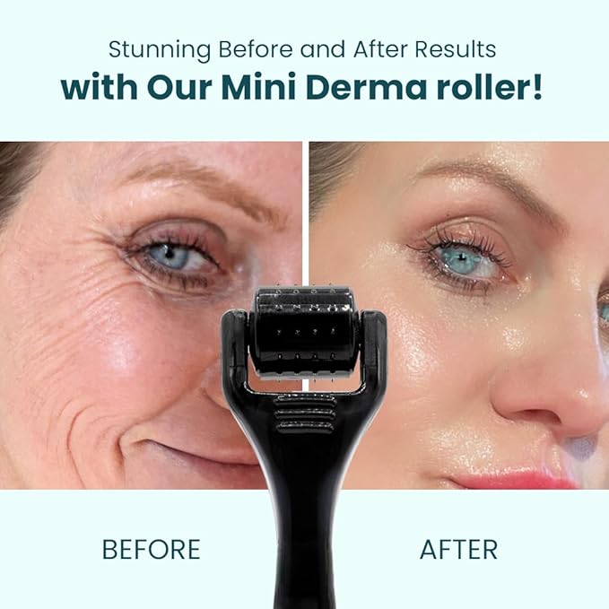 Gin Amber Beauty Mini Derma Roller- 48 Individual Needles for Face, 0.25 mm
