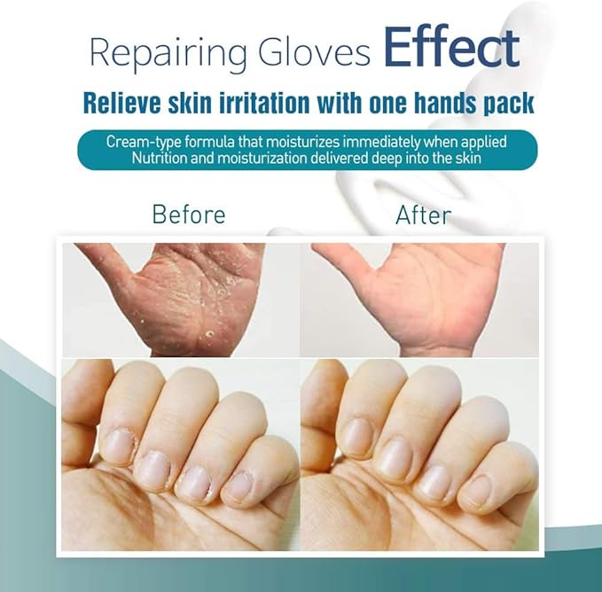 Epielle Intensive Repairing Hand Mask 6 Pairs, Soften with Coconut Oil & Milk Extract, Deep Moisturizing Gloves for Dry, Rough Skin, Self Care Gifts for Women, Spa Kit