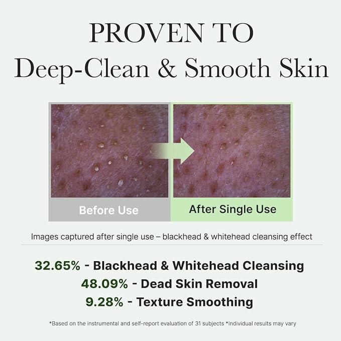 Arencia Korean Rice Mochi Face Cleanser - Face Wash, Gentle Scrub All in One for Deep Cleansing, Moisturizing, Pore Minimizing with Rice Water & Green Tea (4.23oz)