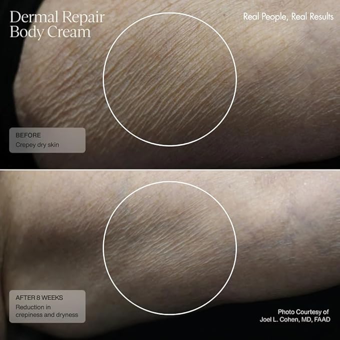 Senté Dermal Repair Body Cream | Firming, Promotes Collagen, 8 Fl Oz