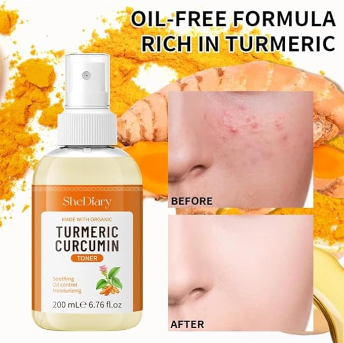 Turmeric Toner Spray Calming Hydrating Soothing Oil Control Moisturizing Face Mist (3)