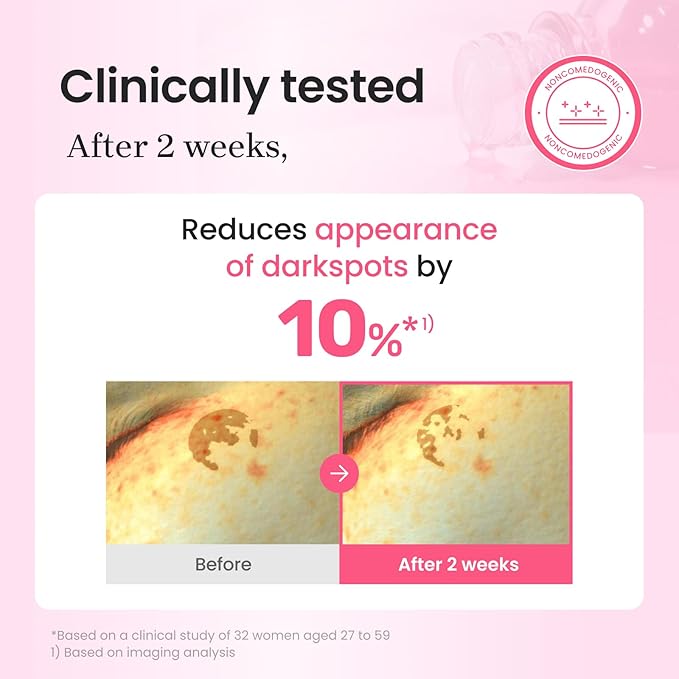 CNP PDRN + Tranexamic Acid Serum, Pink Toning Skin Booster, Niacinamide & Micro-spicules, for Glass Skin, Korean Skin Care, 1. 01 fl. oz. (Pink)