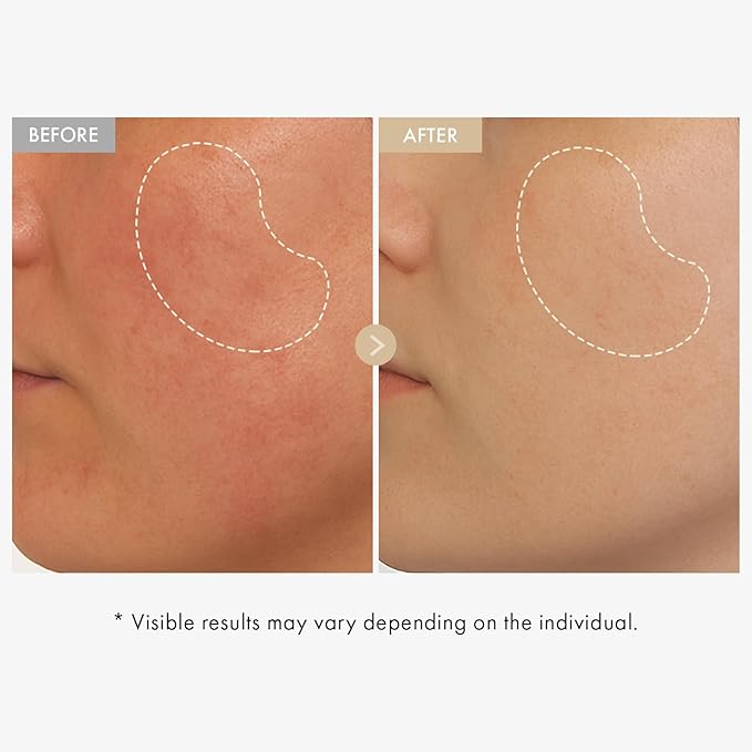 TOSOWOONG Real Rice 80% Glow Serum for Dark Spots & Dull Skin, Uneven Tone