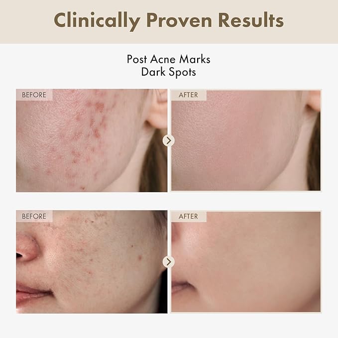 TOSOWOONG Alpha Arbutin 2% Rice Serum for Dark Spots & Even Tone, Glow