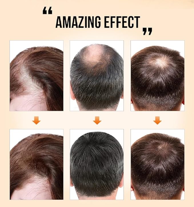 PURC Natural Hair Density Essential Oil,PURC Oil for Hair Growth,Natural Hair Regrowth Serum for Women & Men-35 ML(2 PCS)