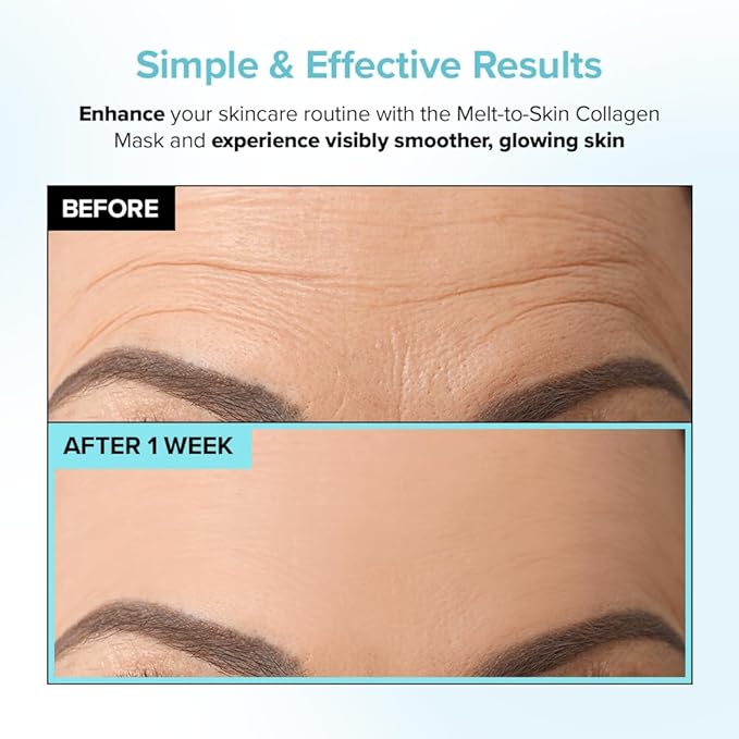 PAIGED Melt to Skin Collagen Mask, – Wrinkle Patches for Forehead, Eyes & Smile Lines - Frown Lines, Eleven-Lines Repair Patches, Invisible Face Wrinkles Smoothers - Korean Skin Care, 4EA