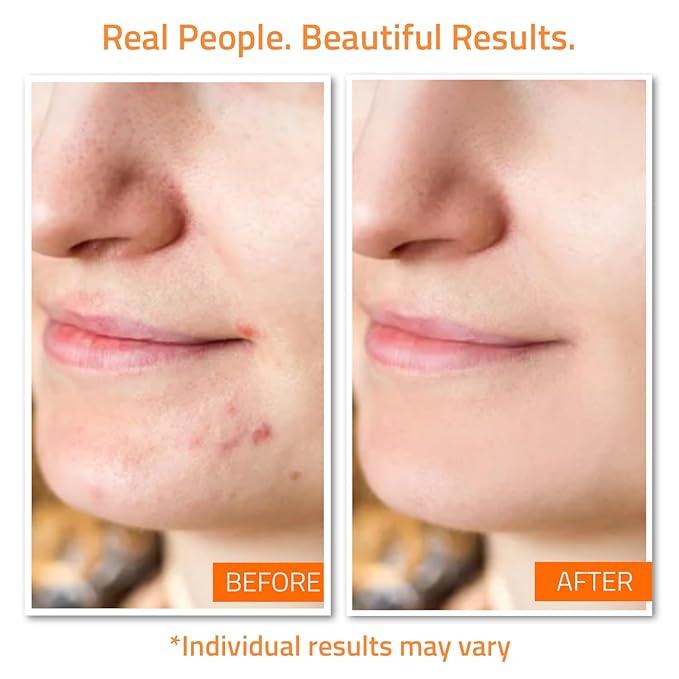 YEOUTH Skin Care Set For Clearer-Looking Skin 7-Piece