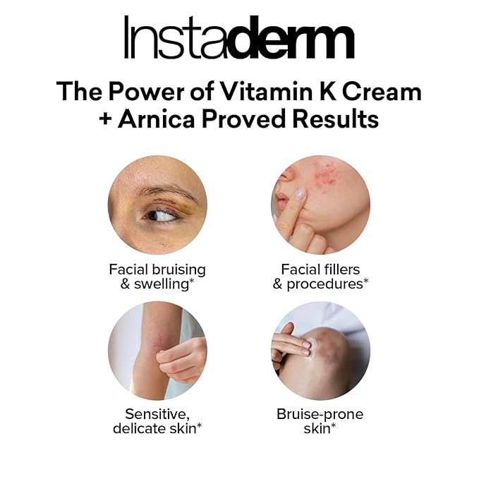 Vitamin K Cream-Revitalizing Formula with Arnica for the Appearance of Brusing, Spider Veins, Broken Capillaries, Uneven Tone & Dark Spot – Under Eye Cream for the Look of Dark Circles & Puffiness