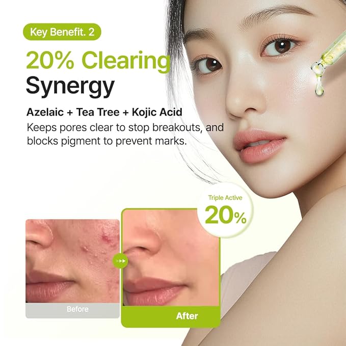 PURITO Azelaic 10% + Kojic Serum | Blemish Care, Redness Relief 1.01 Fl.oz
