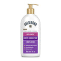 Gold Bond Age Renew Crepe Corrector Body Lotion, 14 Oz