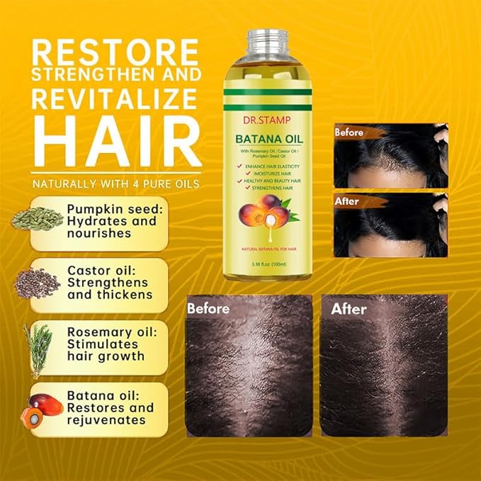 Dr.stamp Batana Oil for Hair Growth & Scalp Care – 4-in-1 Liquid Batana Oil with Rosemary, Castor & Pumpkin Seed Oil – Strengthens, Moisturizes & Revitalizes Dry, Damaged Hair (1 Pack)